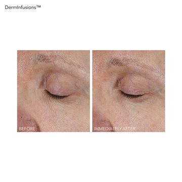 DermInfusions Lift + Repair Eye Mask  1 APP